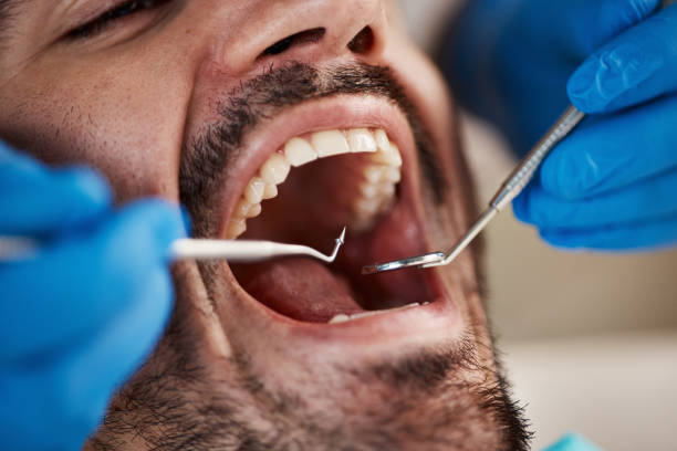 Best Cracked Tooth Emergency Dentist  in Joshua, TX
